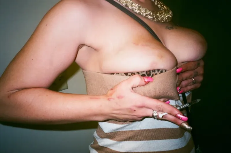 A woman in a striped strapless top with long pink nails, a syringe between her fingers